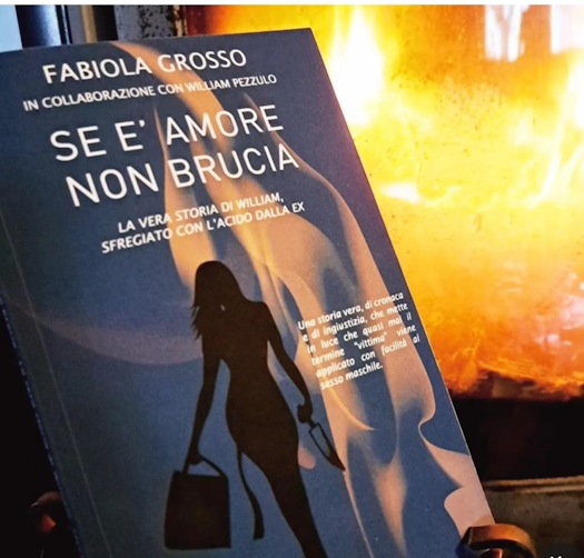 Se è amore non brucia :  la vera storia di William, sfregiato con l'acido dalla ex - di Fabiola Grosso